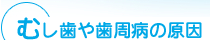 むし歯や歯周病の原因